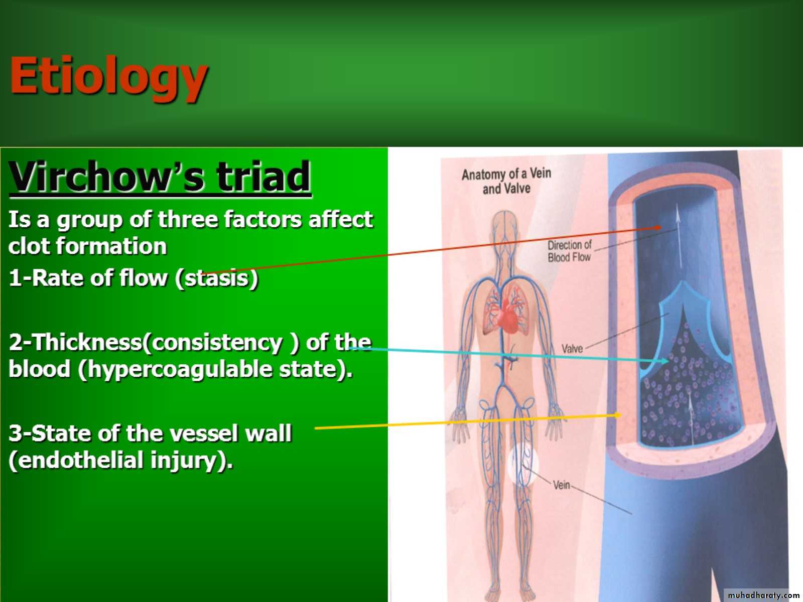 DVT