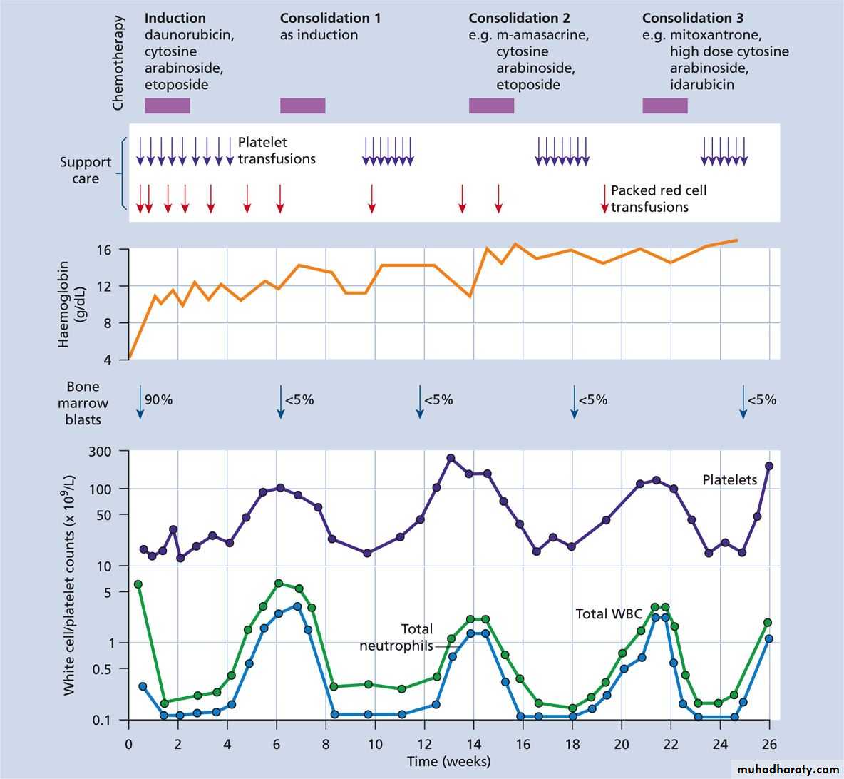 Acute myeloid leukaemia