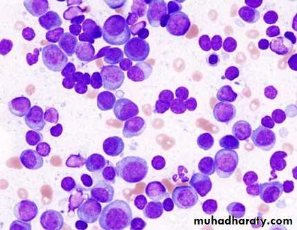 plasma cell tumors