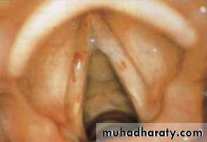 The larynx Lectures