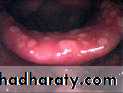 The larynx Lectures
