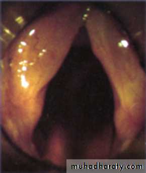 The larynx Lectures