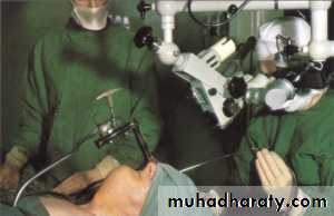 The larynx Lectures