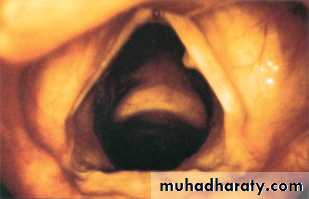 The larynx Lectures