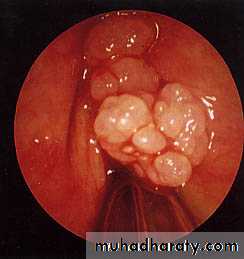 The larynx Lectures