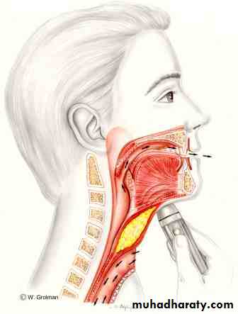 The larynx Lectures