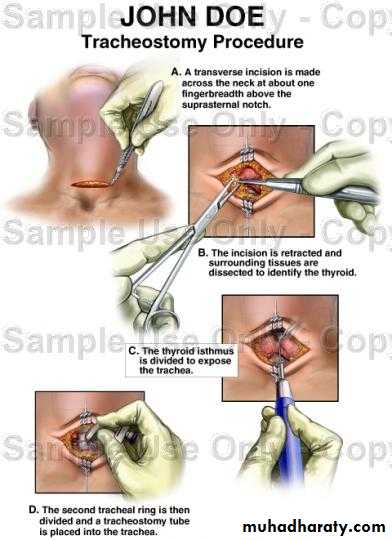 The larynx Lectures