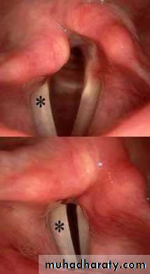 The larynx Lectures