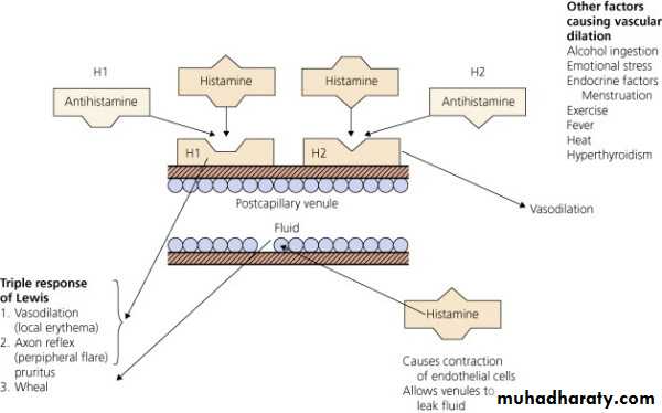 urticaria and angioedema