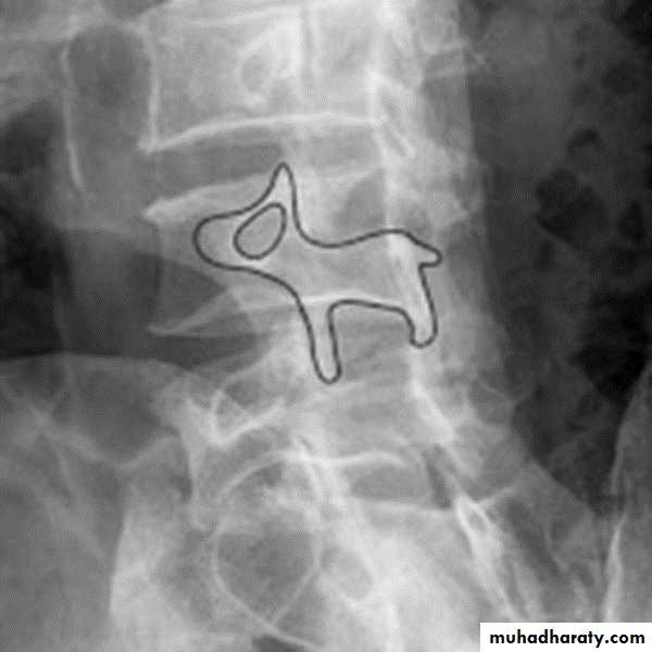 BONE