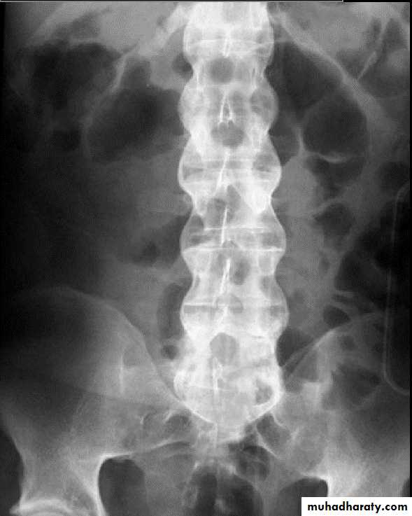 BONE