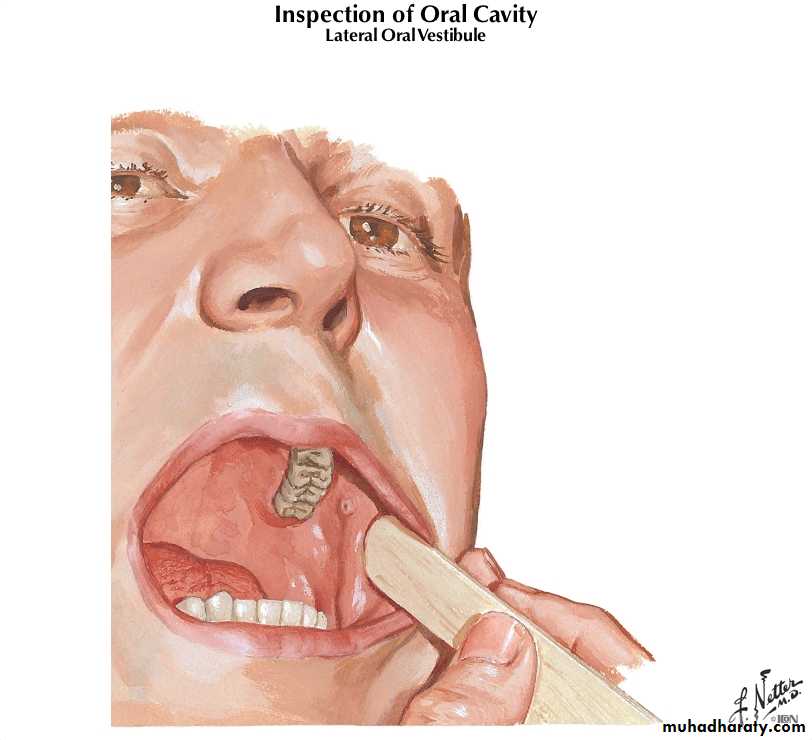 Diseases of salivary glands