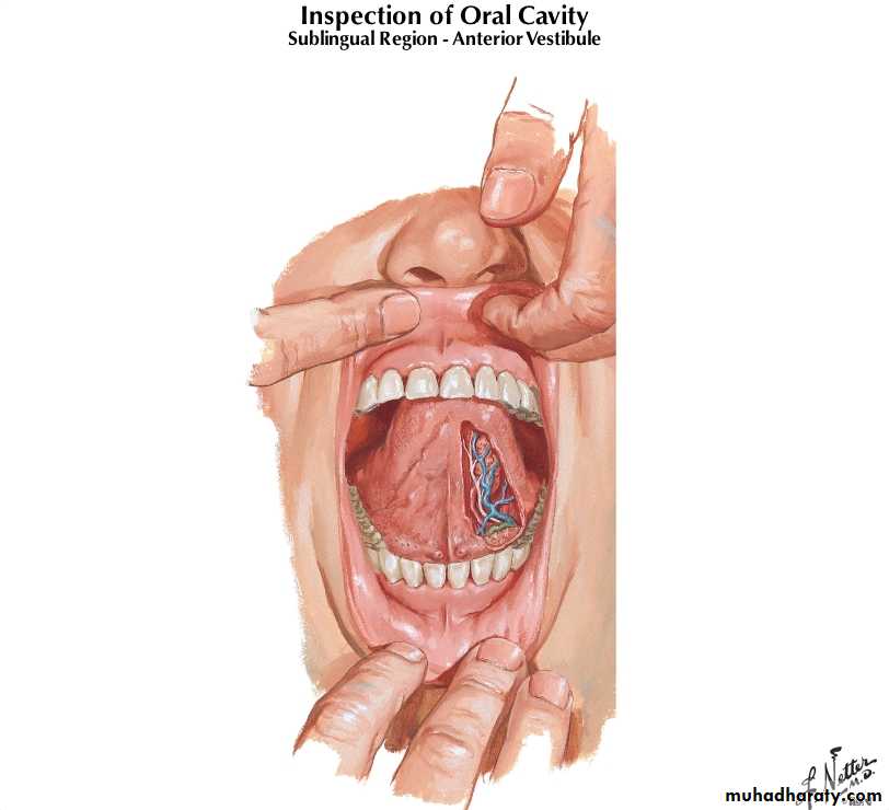 Diseases of salivary glands