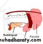 Diseases of salivary glands