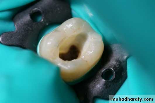 endo
