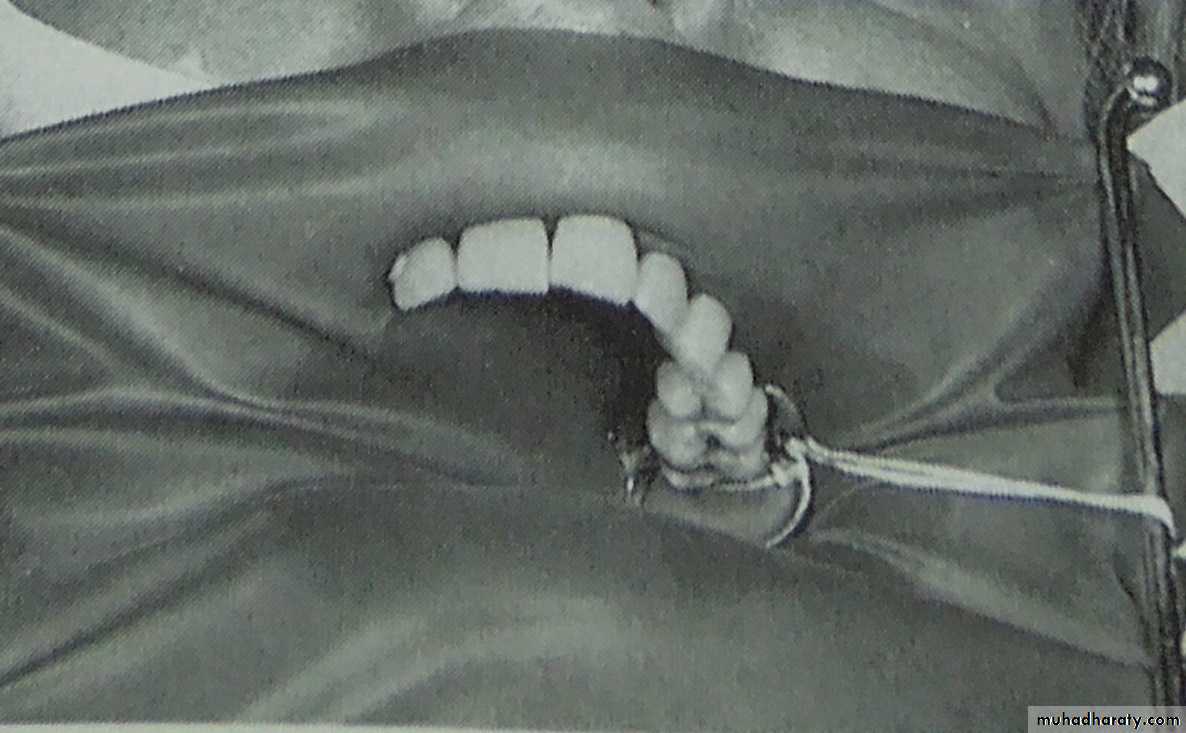 endo