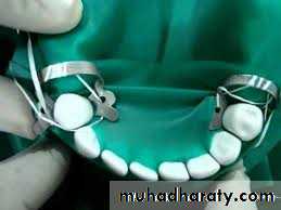 endo