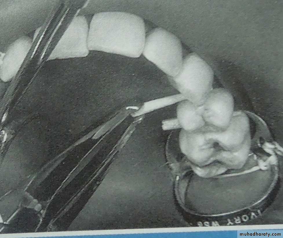 endo