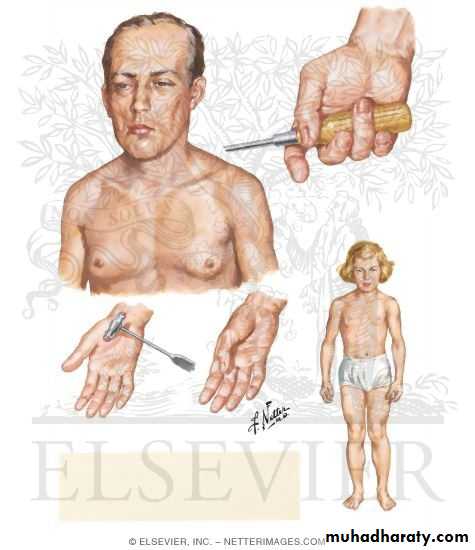 MUSCLE DISEASES ppt