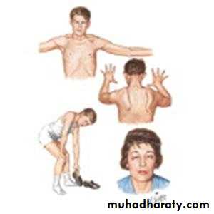 MUSCLE DISEASES ppt
