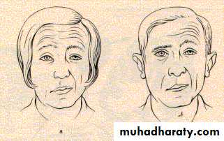 Peripheral Nerve Diseases