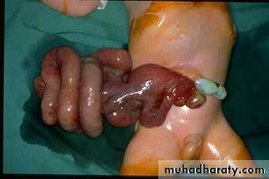 pediatric