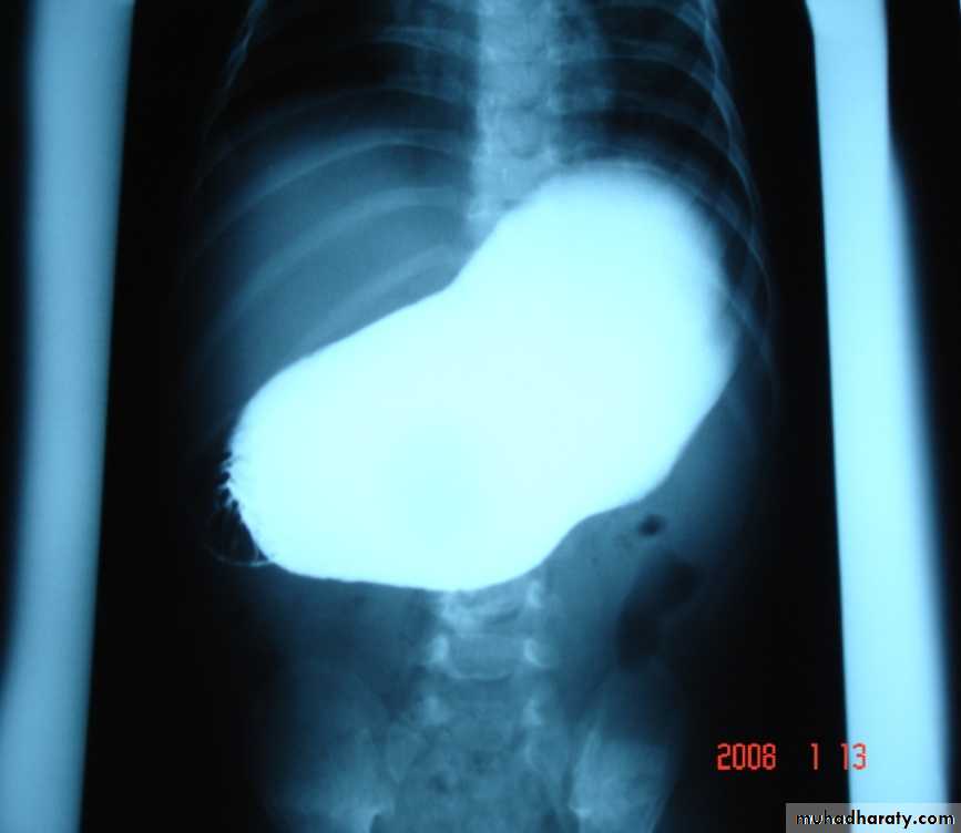 pediatric