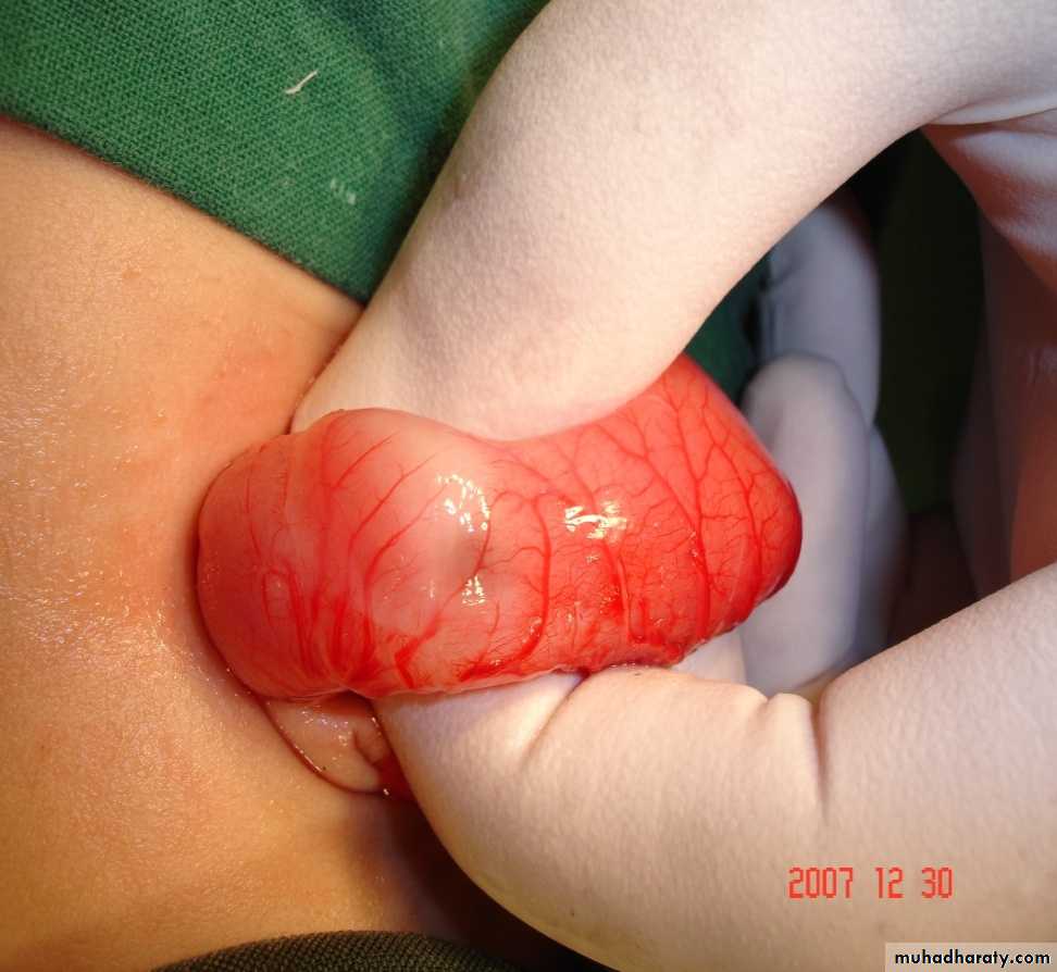 pediatric