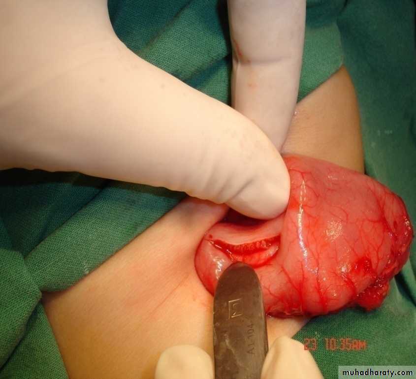 pediatric