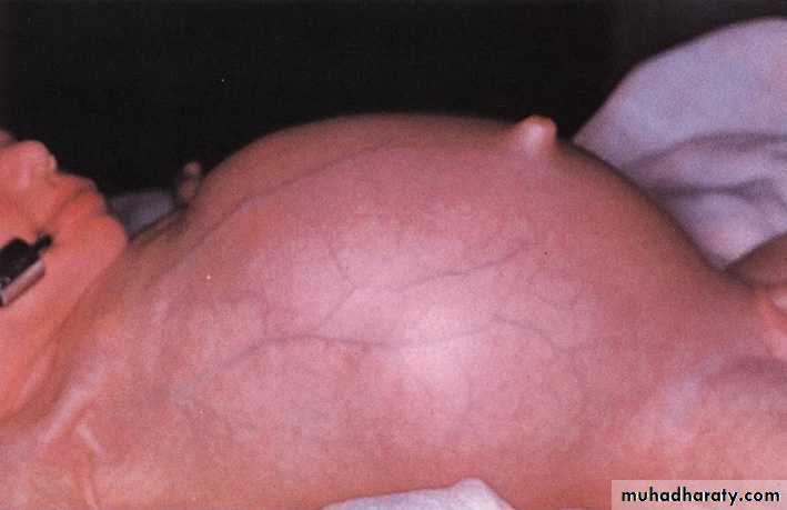 pediatric