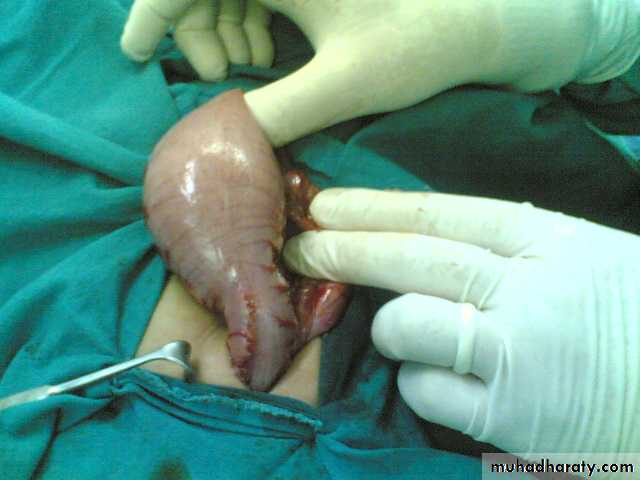 pediatric