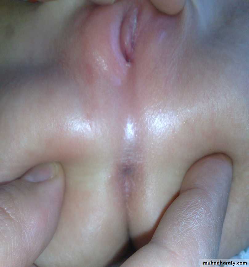 pediatric