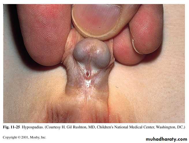 pediatric
