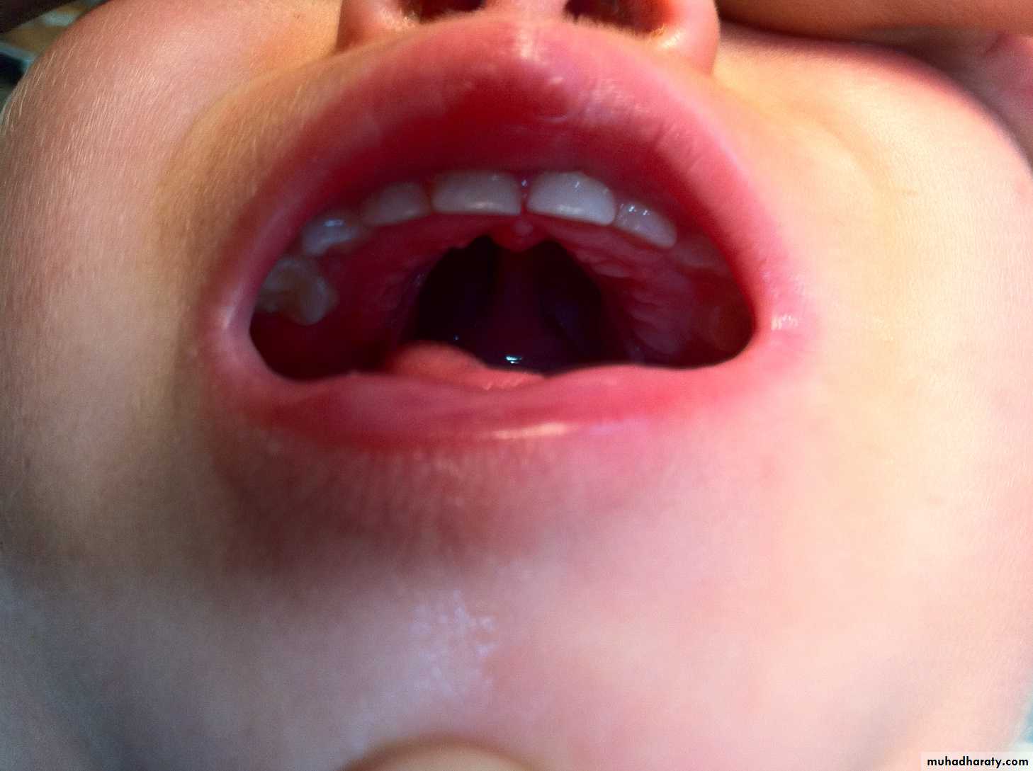pediatric