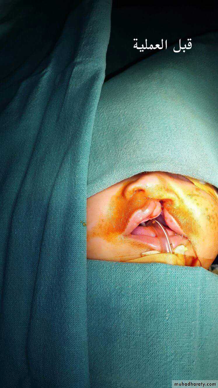 pediatric