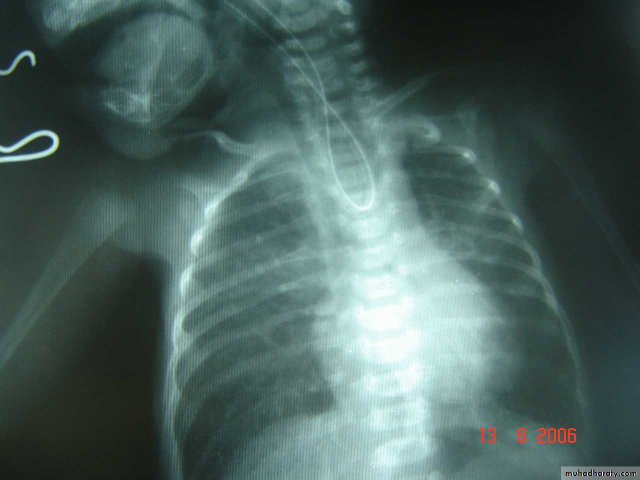 pediatric