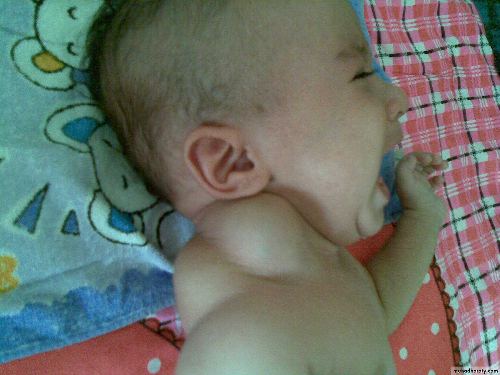 pediatric