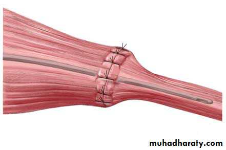 pediatric