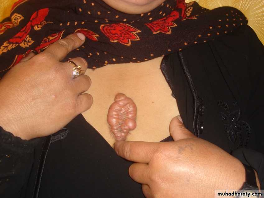 pediatric