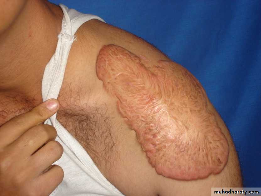 pediatric