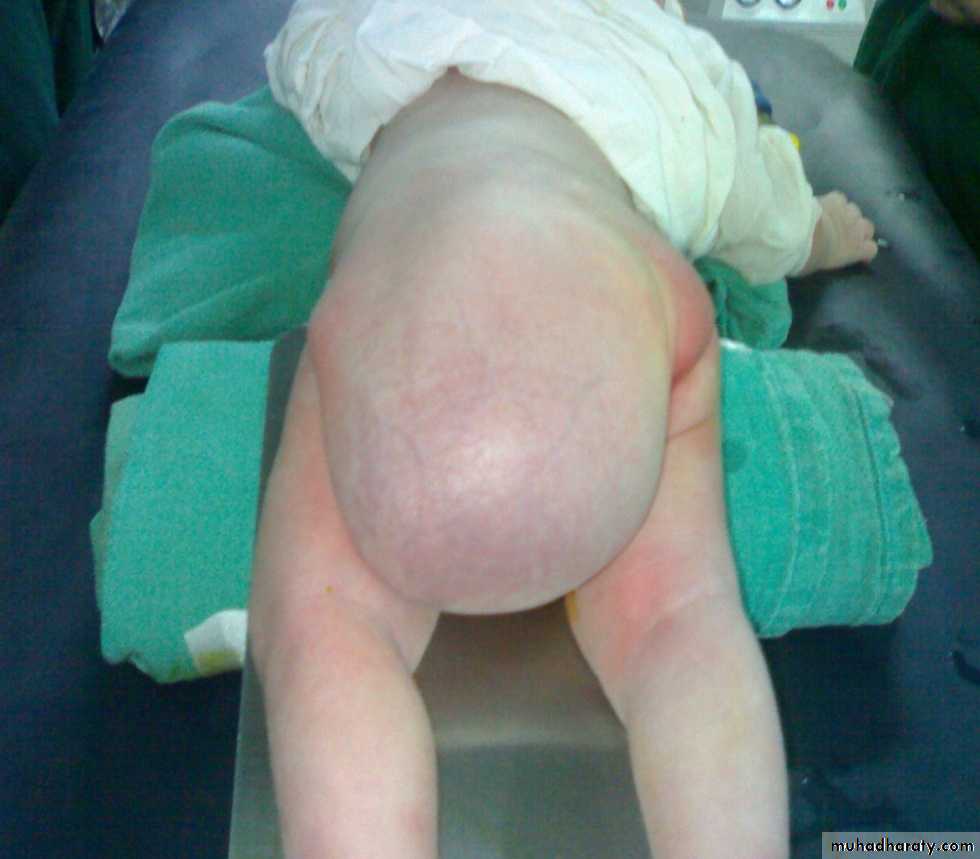 pediatric