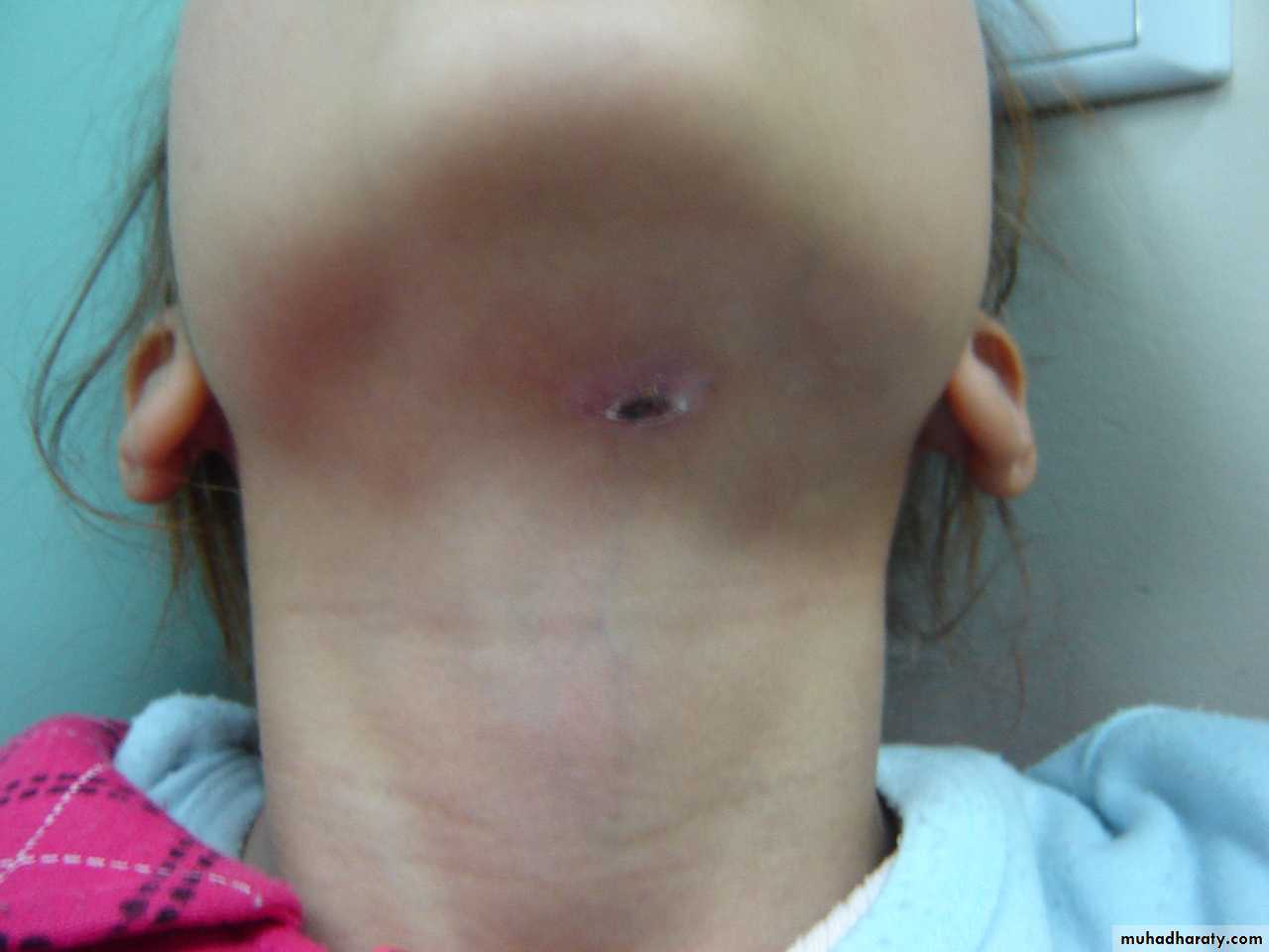 pediatric