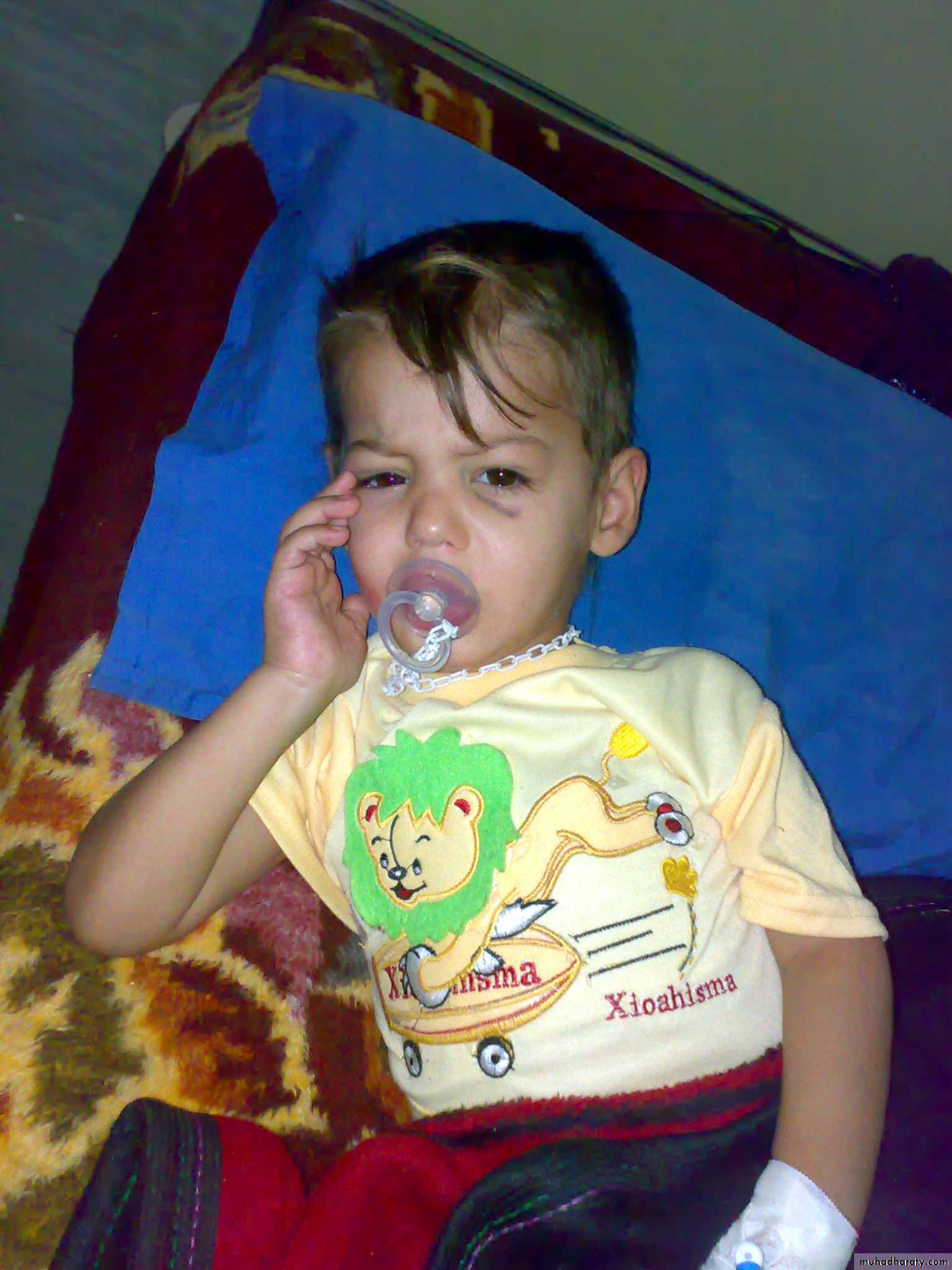 pediatric