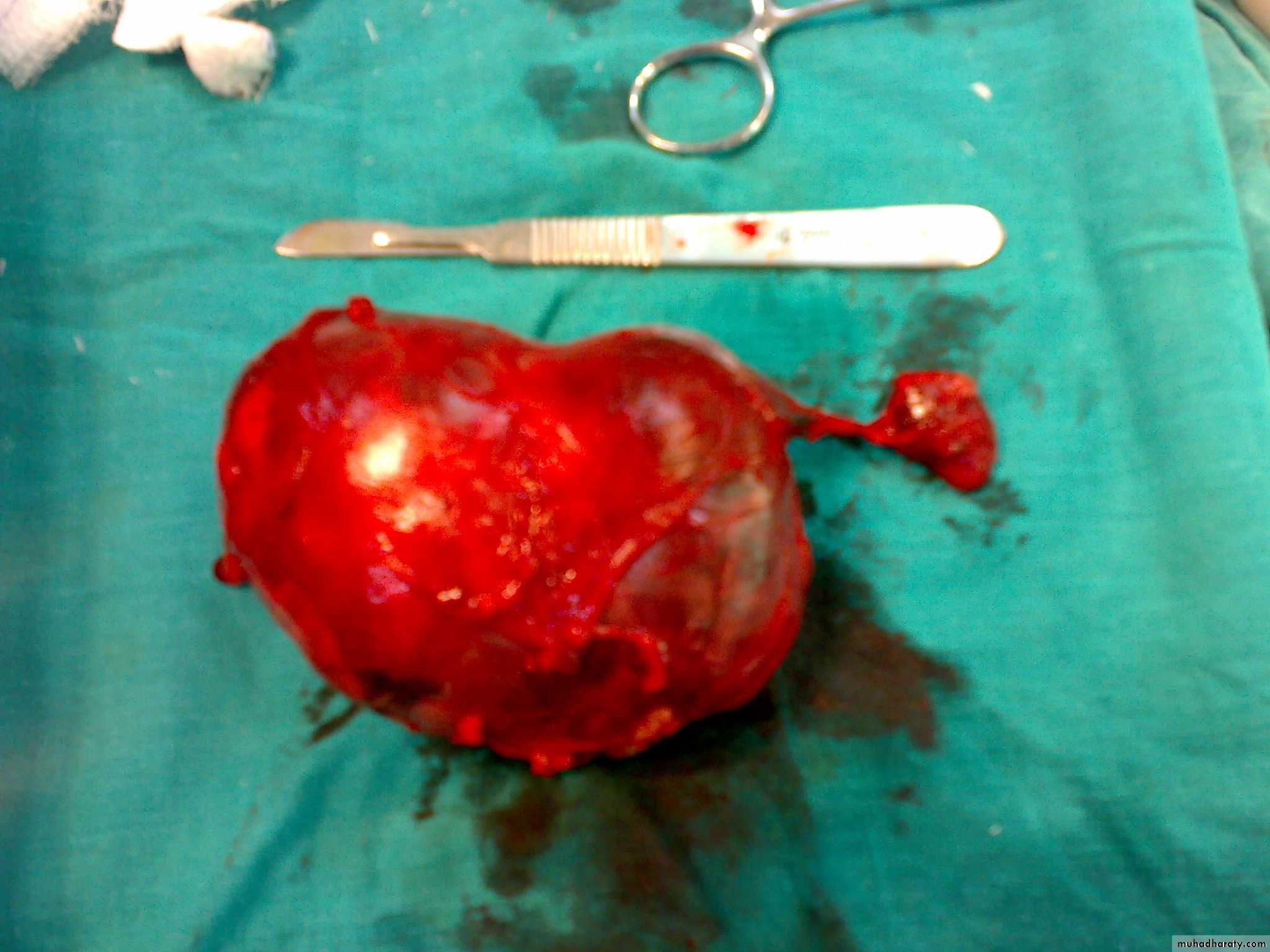 pediatric