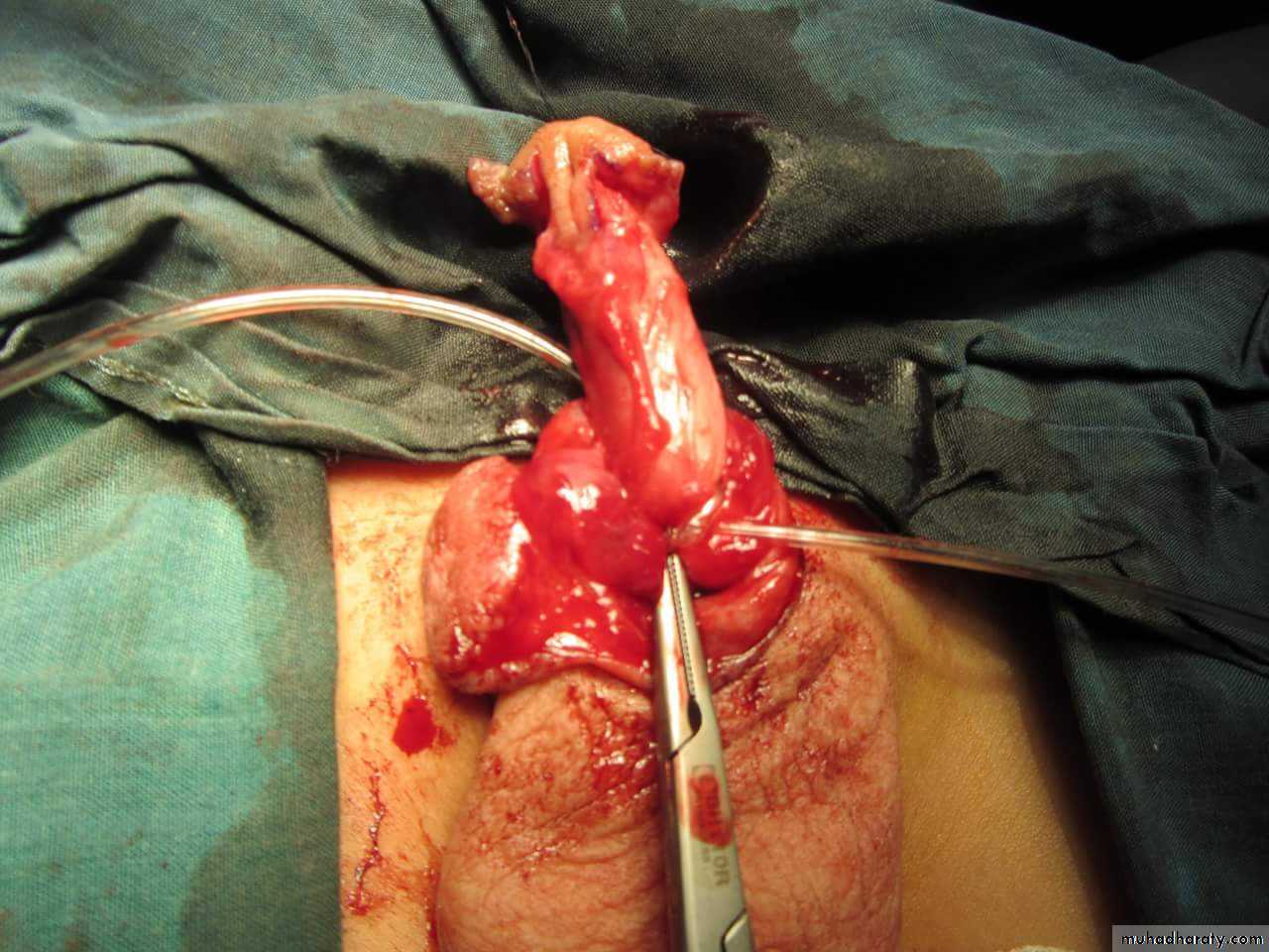 pediatric