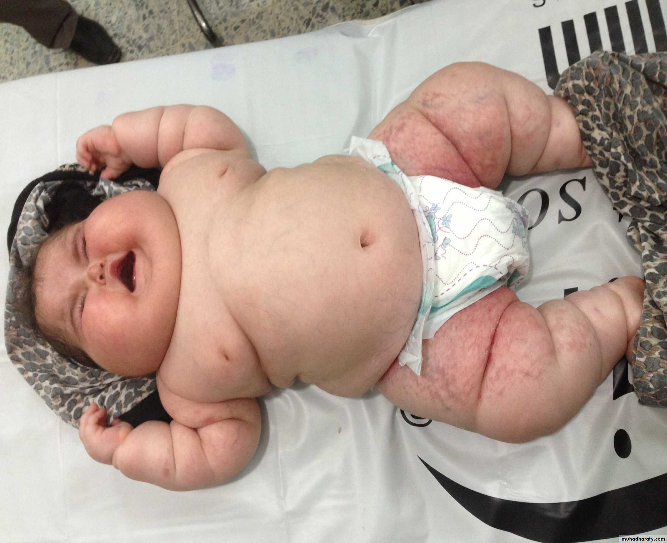 pediatric