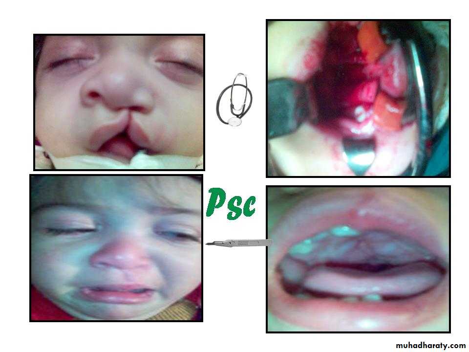 pediatric