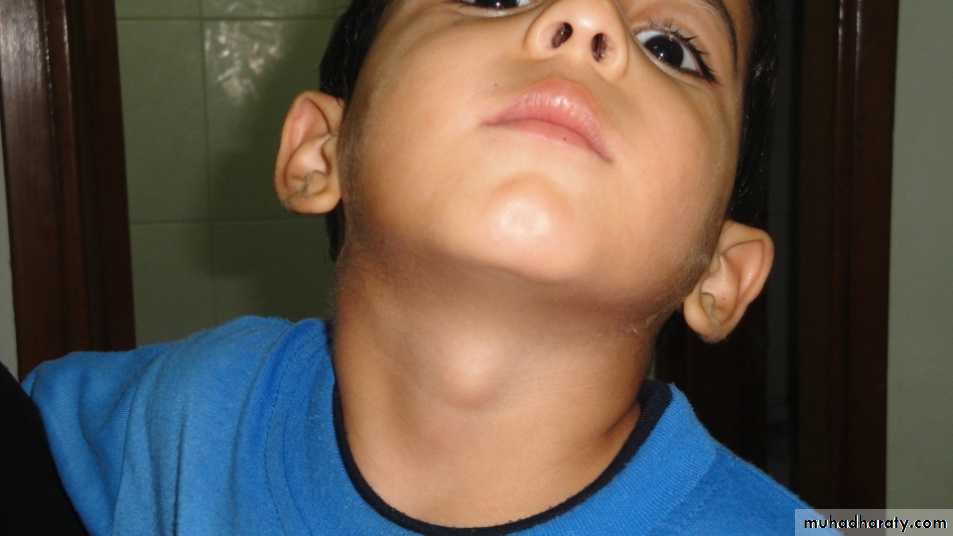 pediatric