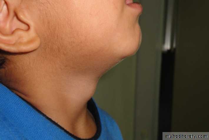 pediatric