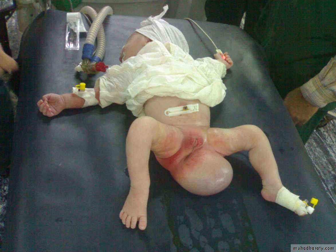 pediatric